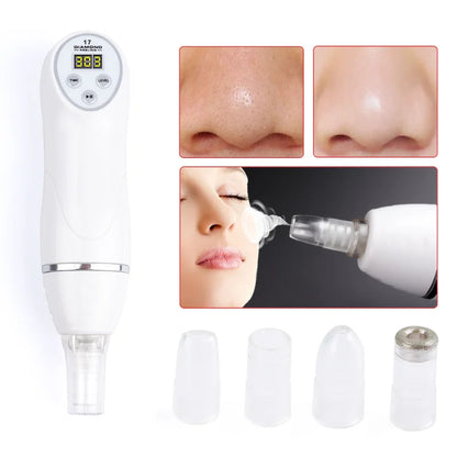 Beauty Digital Diamond Micro-dermabrasion Vacuum Blackhead Cleaner Facial Acne Print Remover Deep Cleansing Pore Skincare