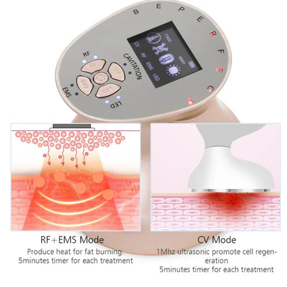 New Radio Cavitation Ultrasound Body Slimming Device 4D 1MHz High Frequency Belly Fat Burn Weight Loss Anti-Cellulite Wrinkle