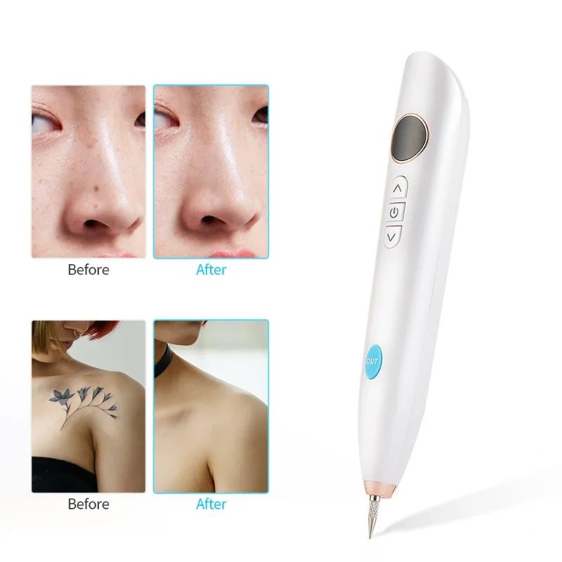 NEW Laser Tattoo Mole Removal Pen Mini LCD Plasma Pen Skin Care Tool Label Removal Freckles Warts Dark Spot Removal Beauty Care