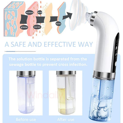 NEW Blackhead Removal Hole Vacuum Cleaner Electric Tiny Bubble Cleanser USB Rechargeable Beauty Device