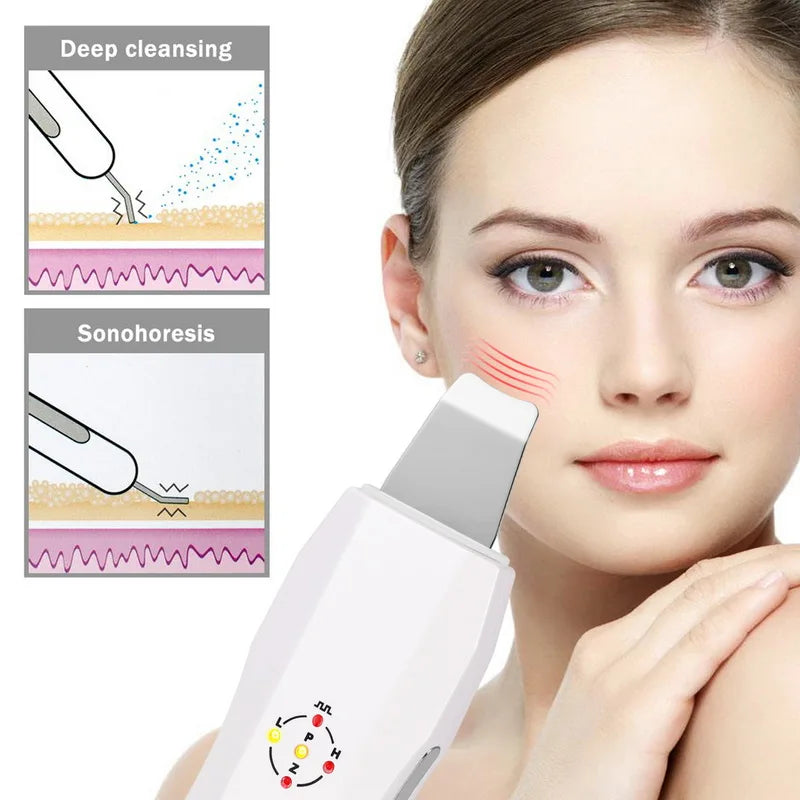 New Facial Spa Massager Ultrasonic Skin Scrubber Face Cleaner Anion Ultrasonic Skin Peeling Face Pore Cleaning Scrubber