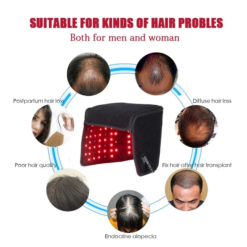 Infrared Anti-hair Loss Treatment Hair Growth Cap Accelerator Hair Rapid Regeneration Hair Care Device Red Light Treatment Cap