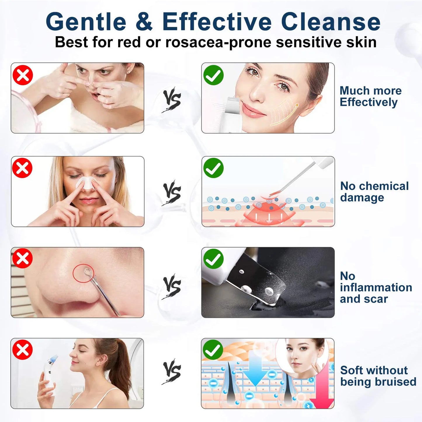 Skin Scrubber Blackhead Remover Sonic Face Skin Cleaning Peeling Device Comedone Extractor Facial Ion Shovel