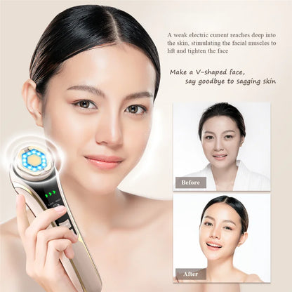 New Facial Massager Radio Mesotherapy EMS Microcurrent LED Photon Therapy Eye Face Lifting Anti Wrinkle Skin Care Beauty