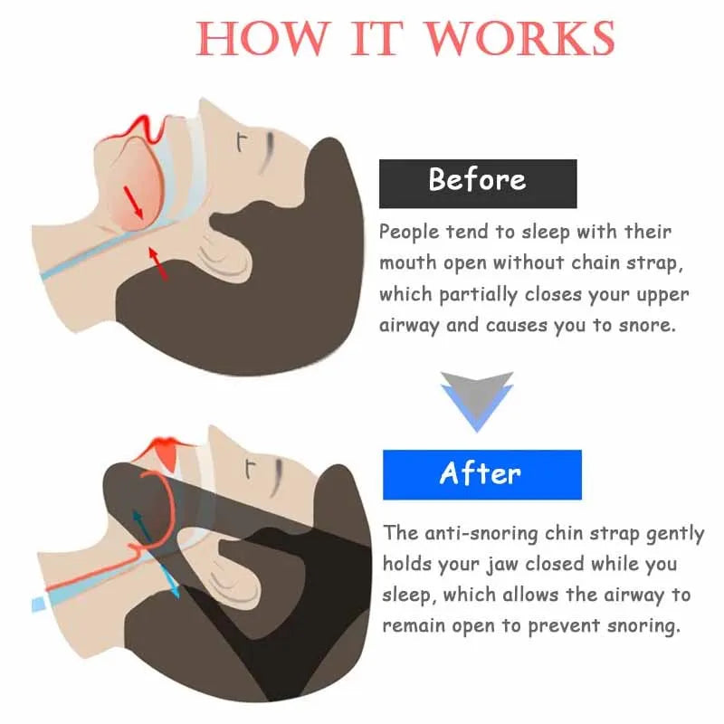 Anti-snoring Strap Stop Snoring Jaw Strap Women Men Night Sleep Aid Snoring Protection Jaw Stop Snoring Bandage One Size