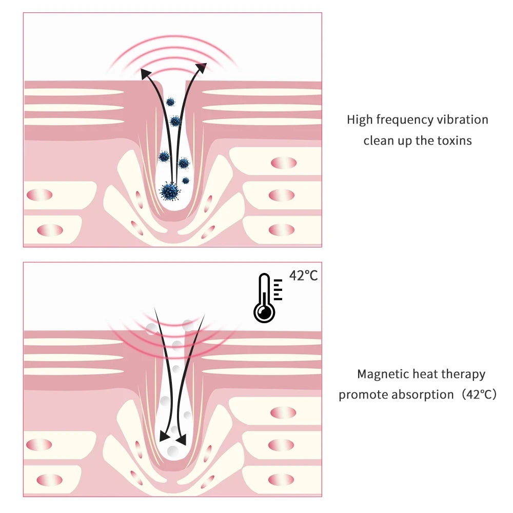 Anti-aging Wrinkle Removal Dark Circle Puffiness Mini Ultrasonic Eye Massager Pen Electric LED Photon Therapy Vibration Heated