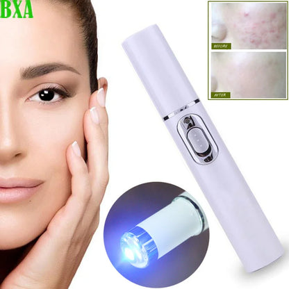 1PCS Blue Light Acne Pen Eye Massager Anti-Pouch Black Heating Eye Massager Stick Eye Beautifying Instrument (White)