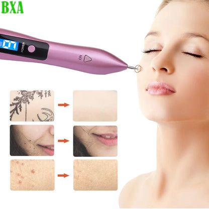 New LCD Plasma Pen Laser Spot Removal Pen Mole Removal Dark Spot Remover Point Pen Skin Wart Tag Tattoo Removal Beauty Tool