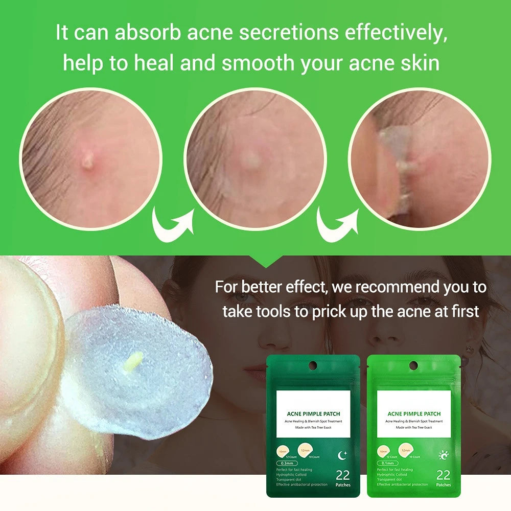 1Pack 22 Tablets Acne Pimple Patch Day And Night Facial Treatment Protects Invisible Acne Removal Blackhead Hydrocolloid Sticker