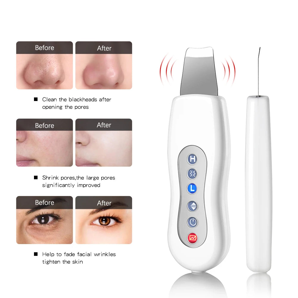 NEW Blackhead Cleanser Device Ultrasonic Cleanser Clean Face Cleanser Facial Hydro Massager Ultrasonic Peel Cleaning Machine