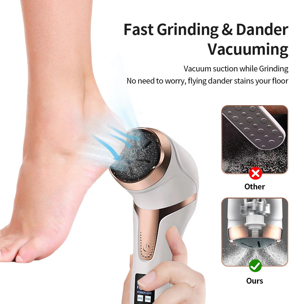 NEW Electric Pedicure Machine Professional Foot Care File Heel Removal of Dead Skin Exfoliating Foot Cleaning Machine Sandpaper