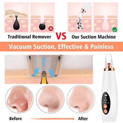 New Electric Blackhead Remover Vacuum Blackhead Extractor Acne Remover Facial Deep Cleansing Pore Cleaner