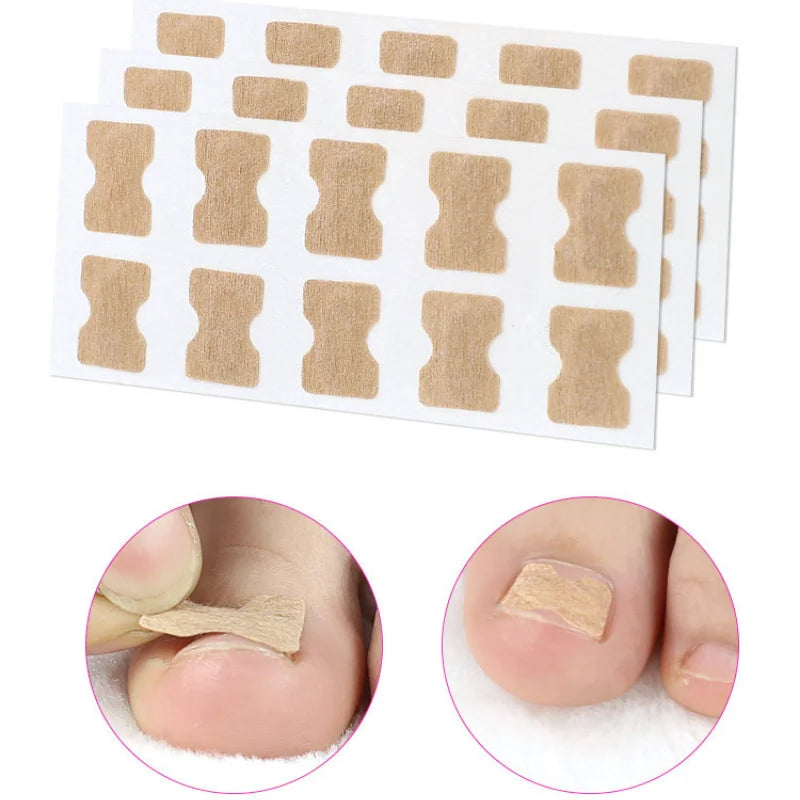 20pcs Inside Growing Toenail Foot Correction Sticker Elastic Toenail Care Pedicure Tool Health Care Toenail Protection