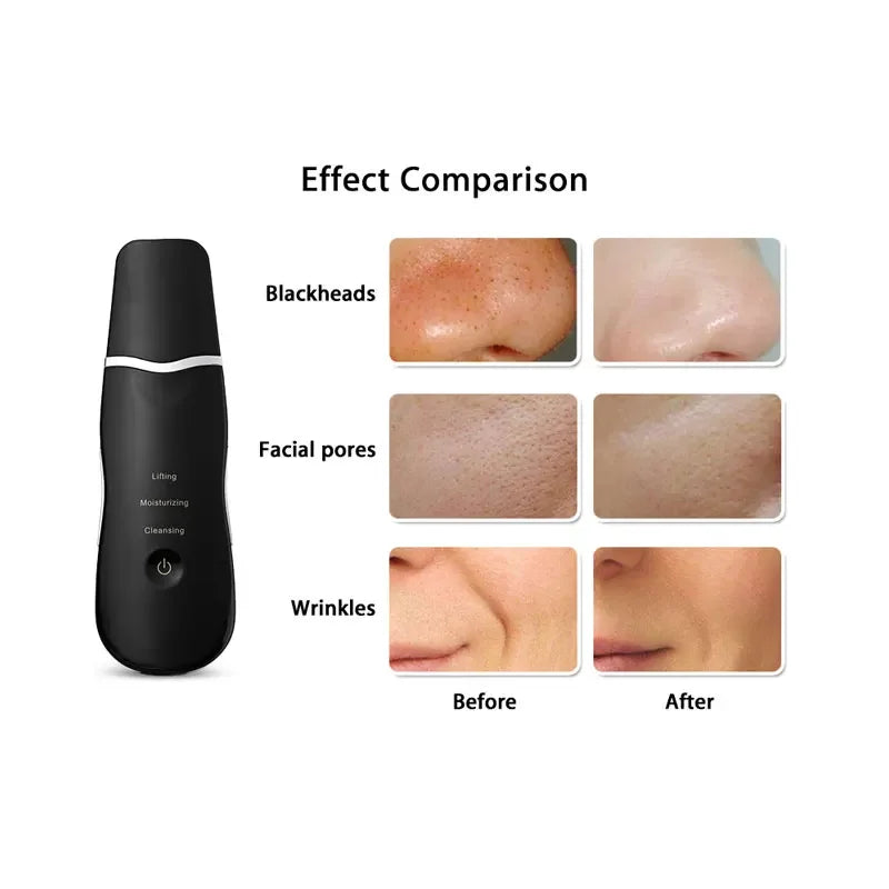 Professional Ultrasonic Ion Deep Face Cleaning Peeling  Facial Skin Scrubber USB Rechargeable Skin Care Device Beauty Instrument