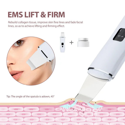 EMS Ultrasonic Skin Scrubber C3 Peeling Shovel EMS Microcurrent Ion Acne Blackhead Remover Face Deep Cleansing Facial Lifting