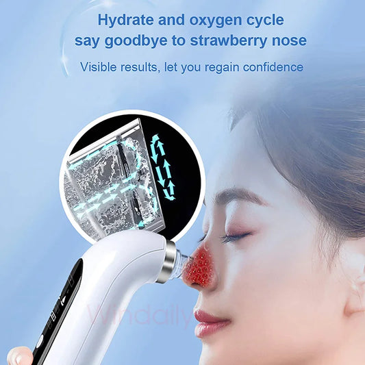 NEW Blackhead Removal Hole Vacuum Cleaner Electric Tiny Bubble Cleanser USB Rechargeable Beauty Device