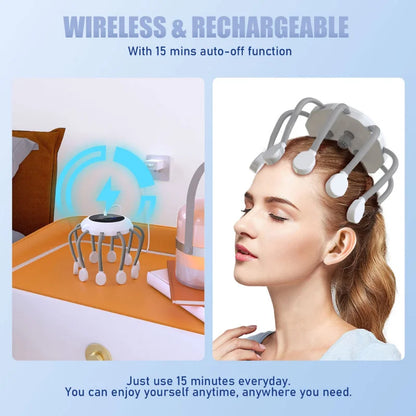 1pc Octopus Electric Scalp Massager Head Massage Therapy Vibrator Head Scratcher for Relaxation Stress Migraine Relief - White