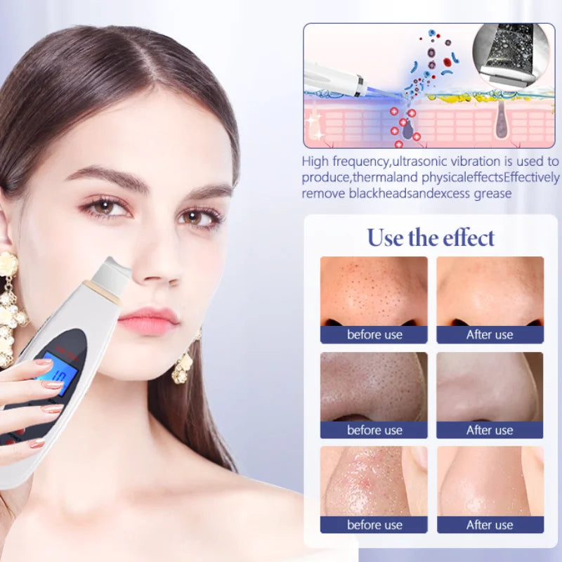 Beauty Peeling Shovel Cleaning Ultrasonic Face Wash Machine Deep Cleaning Facial Massager Peeling Clean Tone Lifting