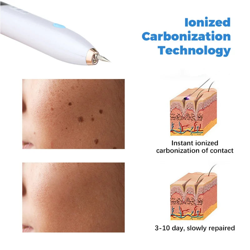 NEW Laser Tattoo Mole Removal Pen Mini LCD Plasma Pen Skin Care Tool Label Removal Freckles Warts Dark Spot Removal Beauty Care