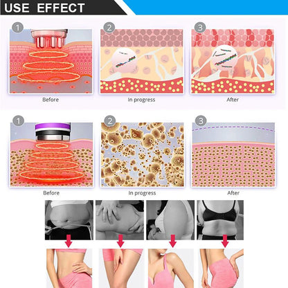 6 In 1 40K Ultrasonic Cavitation Machine Vacuum Body Massager Slimming Anti-cellulite Radio Frequency Lifting Beauty Device