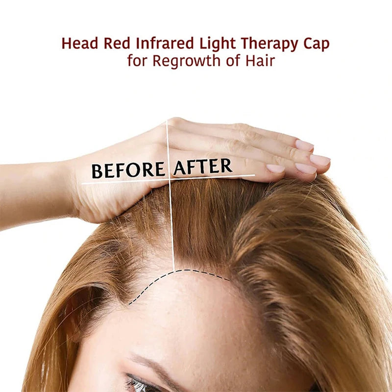 NEW 70-Beads Hair Led Light Treatment for Hair Loss Treatment for Seborrheic Alopecia Areata Hair Growth Red Hair Growth Cap