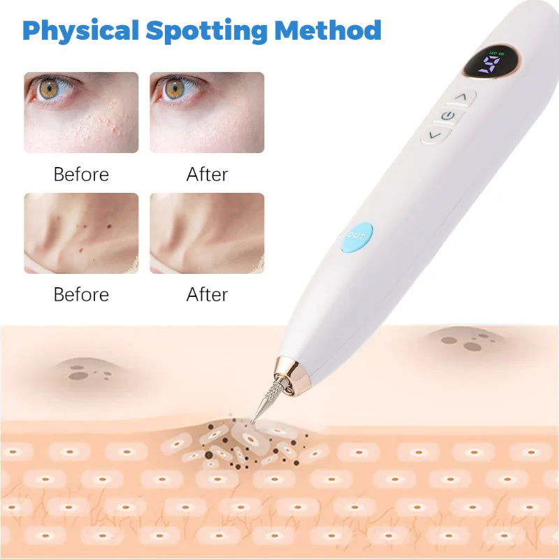 NEW Laser Tattoo Mole Removal Pen Mini LCD Plasma Pen Skin Care Tool Label Removal Freckles Warts Dark Spot Removal Beauty Care