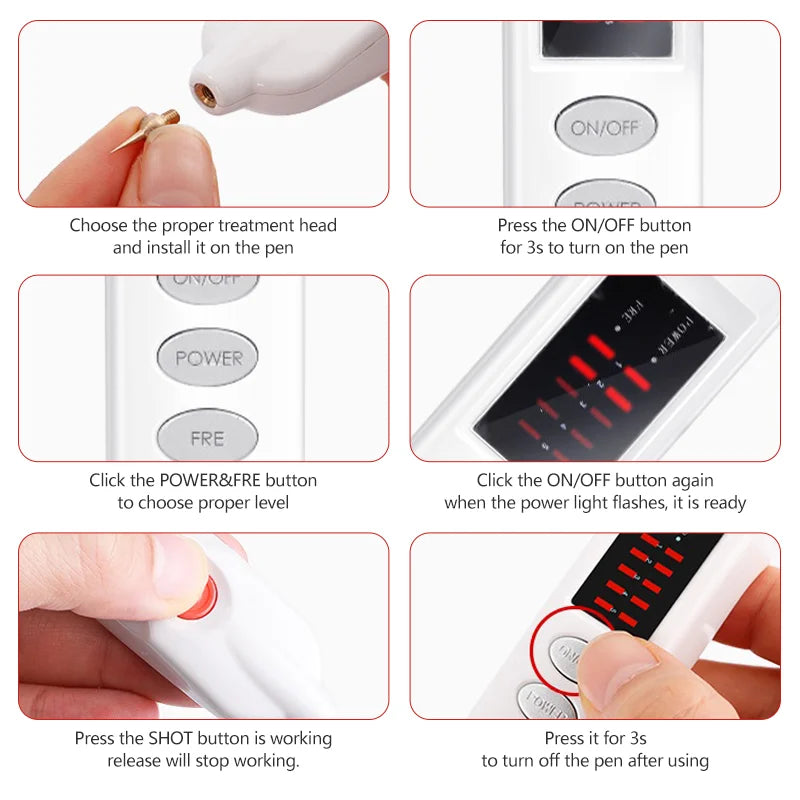 Multifunctional Laser Plasma Pen Charging Home Electric Instrument To Remove Freckles And Black Spots Skin Tags Beauty Machine