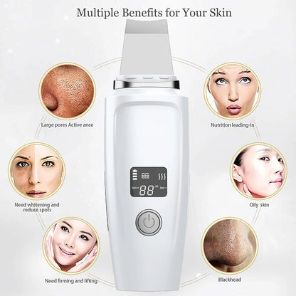 Skin Scrubber Blackhead Remover Sonic Face Skin Cleaning Peeling Device Comedone Extractor Facial Ion Shovel