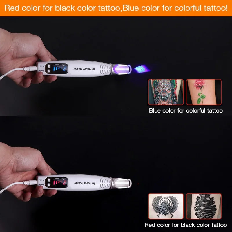 New Blue/Red Light Picosecond Laser Pen Laser Tattoo Removal Machine  Pigment Tattoo Scar Mole Freckle Removal Dark Spot Remover