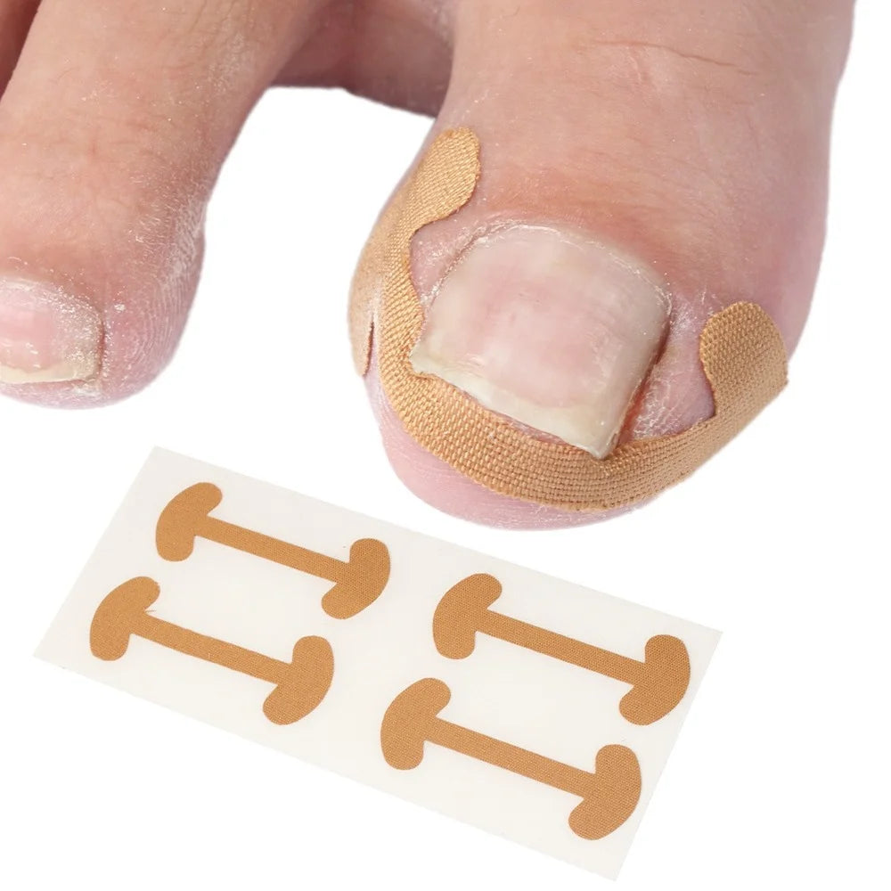 20pcs Inside Growing Toenail Foot Correction Sticker Elastic Toenail Care Pedicure Tool Health Care Toenail Protection