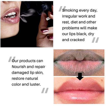 1pc 5g Lip Lightening Lip Balm Remove Dull Black Lip Products Nourish Fade Lips Lines Moisturizing Base Lip Balm Repair Lip Care