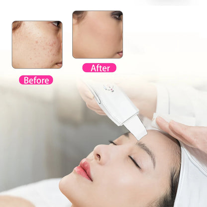 New Facial Spa Massager Ultrasonic Skin Scrubber Face Cleaner Anion Ultrasonic Skin Peeling Face Pore Cleaning Scrubber