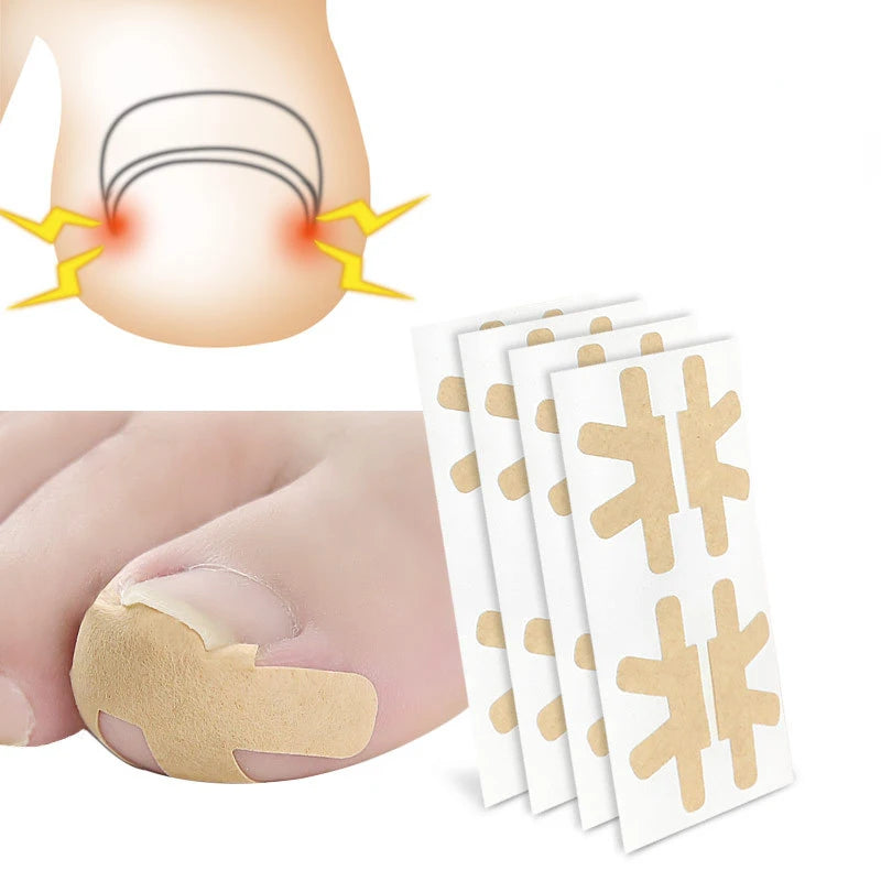 20pcs Inside Growing Toenail Foot Correction Sticker Elastic Toenail Care Pedicure Tool Health Care Toenail Protection