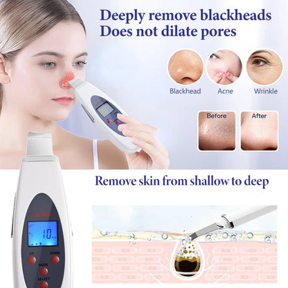 Beauty Peeling Shovel Clean Ultrasonic Skin Scrubber Deep Face Cleaning Machine RemoveFacial Massager Peeling Clean Tone Lift