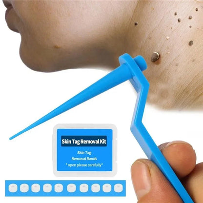 1set Skin Tag Kill Skin Mole Wart Removal Micro Skin Tag Removal Kit with Cleansing Swab Adult Mole Wart Facial Treatment