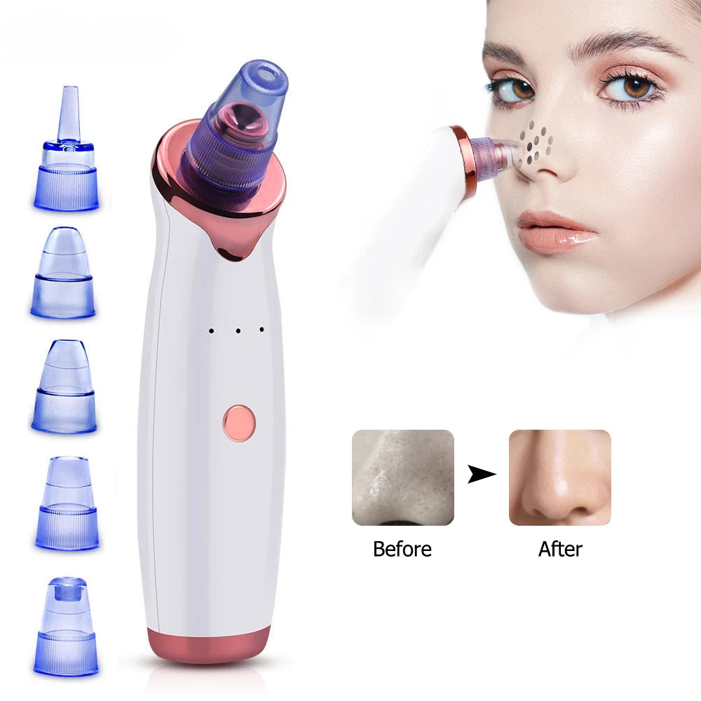 Blackhead Remover Vacuum Electric Nose Beauty Face Deep Cleansing Skin Care Vacuum Black Spots Acne Pore Cleaner Pimple Tool