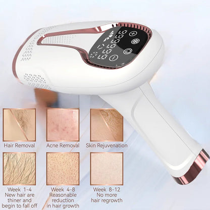 Light Hair Removal Machine Hair Removal Frozen Flash Laser Hair Removal Machine Laser Permanent Ainless Whole Body Hair Removal