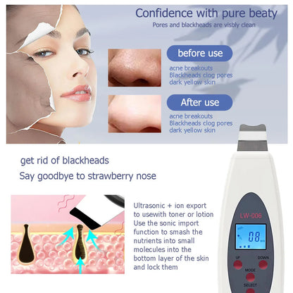 Ultrasonic Skin Scrubber Deep Face Cleaning Machine RemoveFacial Massager Ultrasound Peeling Clean Tone Lift LW006