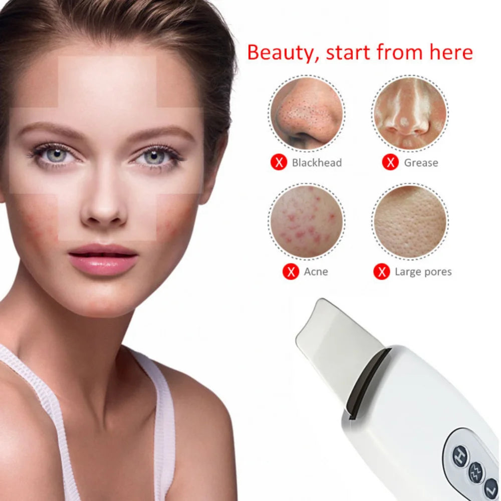 Ultrasound Peeling Clean Tone Lift New Beauty Star Powerful Ultrasonic Face Cleaner Skin Scrubber Ultrasound Vibration Massager